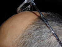 61.kost Priekala detail.JPG